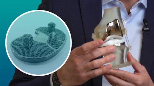 Man holding a surgical knee implant that encourages bone in-growth designed with Siemens software.